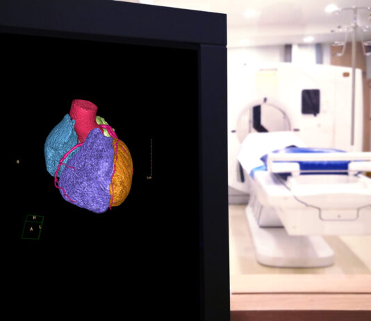 Medisch onderzoek zonder verwijzing mri scan