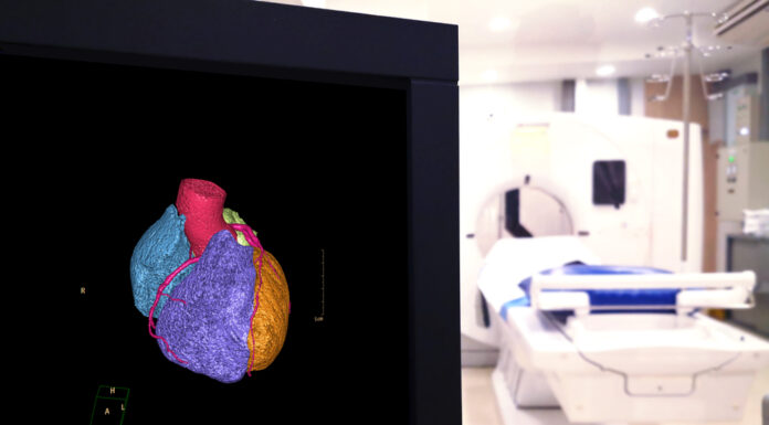 Medisch onderzoek zonder verwijzing mri scan